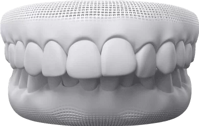 Invisalign Step